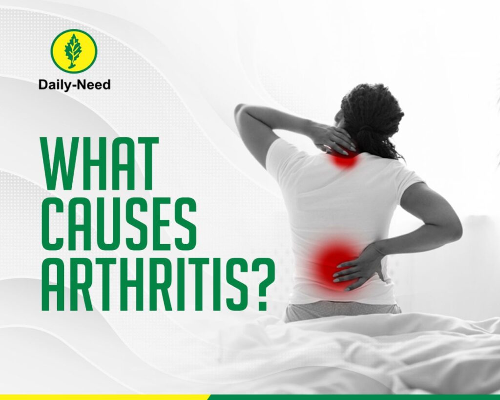 What Causes Arthritis?